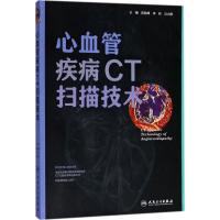 心血管疾病CT扫描技术