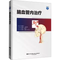脑血管内治疗