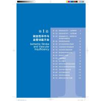 脑血管病诊治决策