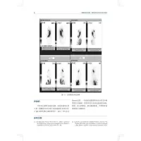 食管良性疾病 现代外科手术方法与技术