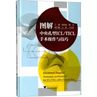 图解中央孔型ICL/TICL手术操作与技巧