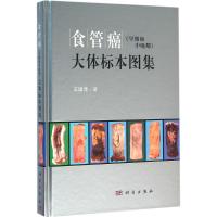 食管癌(早期和中晚期)大体标本图集