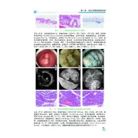 食管胃肠疾病之内镜诊疗
