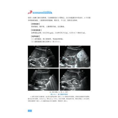 胃肠超声疑难病例解析