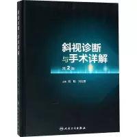 斜视诊断与手术详解 第2版