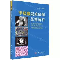 [N]甲状腺疑难病例影像解析-9787030680723