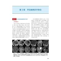 宫剑:小儿神经外科手术笔记2