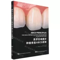 [N]美学区单颗牙种植修复ABCD原则(精)-9787559122667