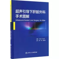超声引导下肝脏外科手术图解