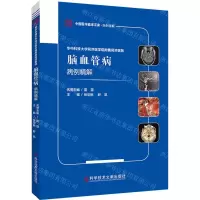[N]华中科技大学同济医学院附属同济医院脑血管病病例精解/中国医学临床百家-9787518993505