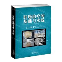 [N]肝癌治疗的基础与实践(精)-9787543340374