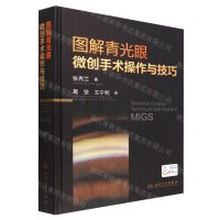 [N]图解青光眼微创手术操作与技巧(精)-9787117332927