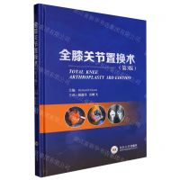 [N]全膝关节置换术(第3版)(精)-9787548750208