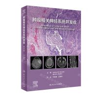 [N]肿瘤相关神经系统并发症(第2版)(精)-9787117347471