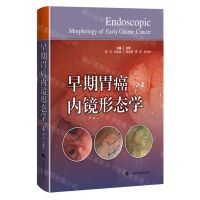 [N]早期胃癌内镜形态学(精)-9787547861967