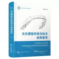 [N]无托槽隐形矫治技术病例荟萃(精)-9787559124449