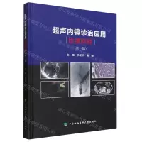 [N]超声内镜诊治应用思维例释(第1辑)(精)-9787567922228