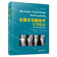 [N]全膝关节翻修术(实用指南)(精)-9787523600115