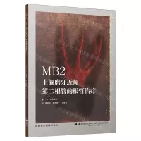 [N]MB2(上颌磨牙近颊第二根管的根管治疗)-9787559131362