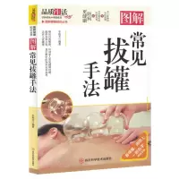 [N]图解常见拔罐手法/图解健康知识丛书-9787572709005