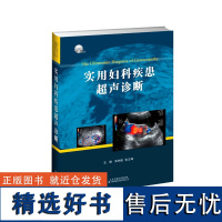 实用妇科疾患超声诊断(赠3张DVD光盘) 异位妊娠 子宫内膜异位症的超声诊断 多囊卵巢综合征超声诊断 妇科超声医生参考