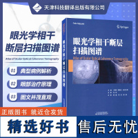 [ ]眼光学相干断层扫描图谱 新型层析成像技术OCT技术 眼科疾病诊疗病理性近视遗传性疾病炎性疾病眼科常见疾病