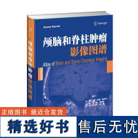 []颅脑和脊柱肿瘤影像图谱 脑和脊髓肿瘤病例解析 脑和脊髓肿瘤的鉴别诊断方法 天津科技翻译出版社 97875433358