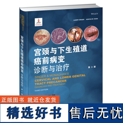 []宫颈与下生殖道癌前病变诊断与治疗 宫颈癌前病变诊治方法 非感染因素引起的女性宫颈等病症 阴道镜检查