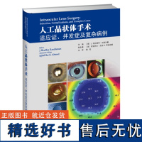 人工晶状体手术:适应证、并发症及复杂病例 人工晶状体选择 人工晶状体手术并发症处理人工晶状体植入方式人工晶状体展望