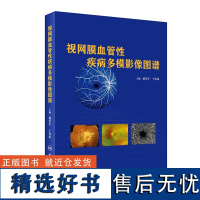 视网膜血管疾病多模影像图谱戴荣平、于伟泓9787117297837人民卫生