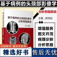 基于病例的头颈部影像学分析思路解读 人民卫生出版社9787117310482