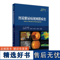 图说糖尿病视网膜病变 图说眼科系列 糖尿病与糖尿病眼部并发症 糖尿病视网膜病变流行病学特征 糖尿病血视网膜屏障破坏参考书