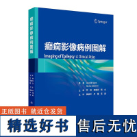 癫痫影像病例图解 翻译版 神经内科专家和神经影像专家所著的关于癫痫的影像诊断图谱 癫痫诊断和治疗中的作用 治疗后表现指南