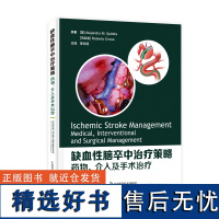 缺血性脑卒中治疗策略:药物、介入及手术治疗 国际视野 | 权威指南 | 全城管理 | 新兴技术