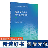 腹部血管疾病超声图解100例 2024年4月其它教材