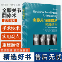 全膝关节翻修术实用指南 复杂初次全膝关节置换术 全膝关节翻修术的适应证 旋转饺链假体 手术 中国科学技术出版9787