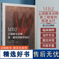 MB2上颌磨牙近颊第二根管的根管治疗 MB2解剖形态到临床处理方法技能 牙体牙髓病学临床诊疗根管治疗图谱 CBCT应用后