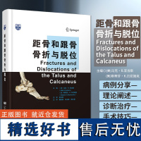 距骨和跟骨骨折与脱位 魏世隽等译 距骨跟骨骨折跗骨脱位手术治疗临床处理及创伤后护理重建 辽宁科学技术出版社9787559