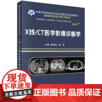 X线/CT医学影像诊断学