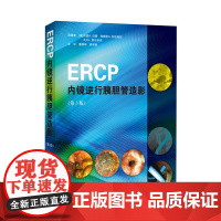 ERCP内镜逆行胰胆管造影