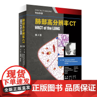 肺部高分辨率CT(翻译版)