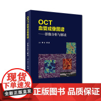 [店] OCT血管成像图谱影像分析与解读蒋沁姚进眼科学眼视光青光眼眼镜玻璃体视网膜手术学眼底照相人民卫生出版社眼科书