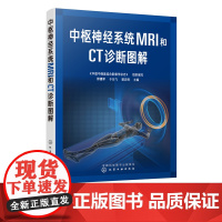 中枢神经系统MRI和CT诊断图解 修建军中枢神经系统常见疾病影像学特点及鉴别诊断书籍先天性疾病颅脑损伤脑卒中血管性病变影