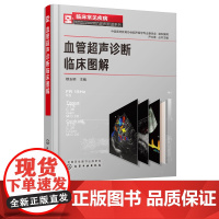 血管超声诊断临床图解 穆玉明 颅脑血管 颈部血管 腹部血管 门脉系统 常见疾病诊断与治疗书籍 血管超声检查指南与读片实践