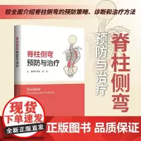 脊柱侧弯:预防与治疗/主编 叶祥明 周亮/浙江大学出版社