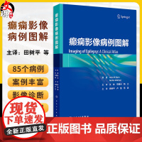 癫痫影像病例图解 田树平 卢强 范淼 癫痫PET/MR及MR诊断治疗疗效评估 临床病例影像诊断图谱影像表现9787117