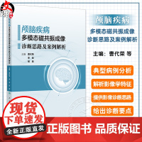 颅脑疾病多模态磁共振成像诊断思路及案例解析 曹代荣 李坚 邢振 常见颅脑疾病多模态磁共振成像典型病例分析 9787117