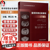 腹部影像征象解析 下册 贾云生等主编 深入理解腹部影像学 涵盖了解刨结构和疾病变化 常见和罕见腹部影像征象 978752