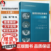 腹部影像征象解析 上册 李广明等 肝脏未分化胚胎型肉瘤 气肿性胆囊炎 肝脏平滑肌肉瘤 假性肝硬化 科学技术文献出版978