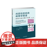 间质性肺疾病病理学图谱:病理与高分辨CT对照(第2版) 阳云平 本书专门针对间质性肺疾病(ILD)在临床实践中的应用进行